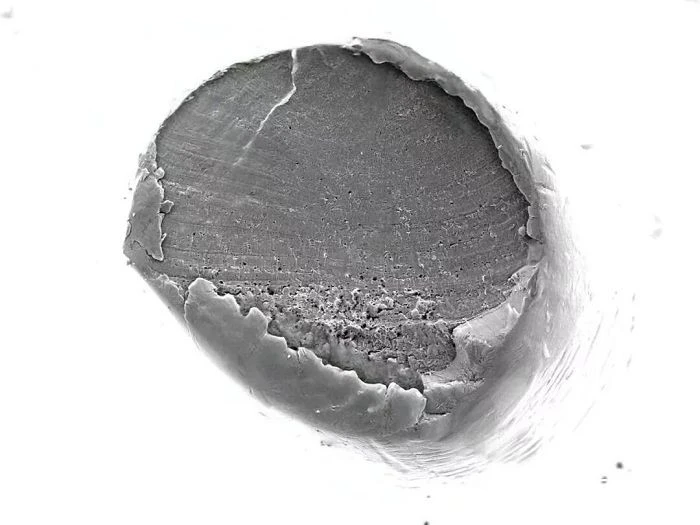 Fracture Detection best